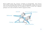 Preview for 41 page of Advanced Bionics Auria iConnect Instructions For Use Manual