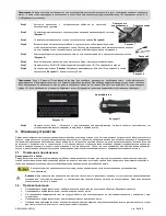 Preview for 356 page of Chattanooga LIGHTFORCE XLi Instructions For Use Manual