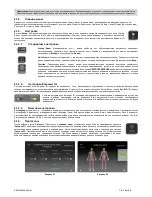 Preview for 361 page of Chattanooga LIGHTFORCE XLi Instructions For Use Manual