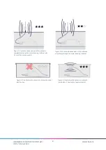 Preview for 4 page of Chess Mymesh mini BLC 4DI Installation Instruction