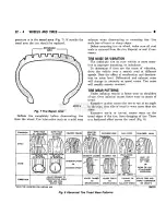 Preview for 1373 page of Chrysler DODGE AD100 1993 Service Manual