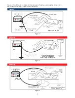 Preview for 8 page of Cooper Surgical LEEP PRECISION LP-20-120 Operating Manual