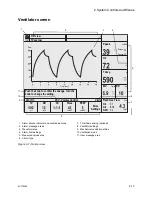 Preview for 29 page of Datex-Ohmeda Aespire View User'S Reference Manual