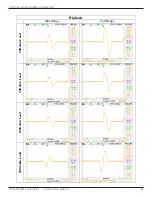 Preview for 100 page of Dynatronics Dynatron 525 Operator'S Manual