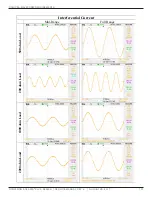 Preview for 145 page of Dynatronics dynatron solaris 705 plus Service Manual