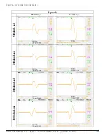 Preview for 148 page of Dynatronics dynatron solaris 705 plus Service Manual