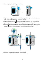 Preview for 28 page of Fresenius Kabi Ambix nova Instructions For Use Manual