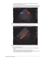 Preview for 13 page of Gammex Doppler 403 Flow Phantom Manual