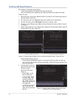 Preview for 14 page of Gammex Doppler 403 Flow Phantom Manual