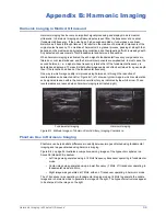 Preview for 39 page of Gammex Doppler 403 Flow Phantom Manual