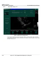 Preview for 322 page of GE Vivid 3N Pro Series Service Manual