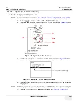 Preview for 135 page of GE Voluson i BT06 Service Manual