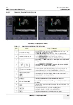 Preview for 203 page of GE Voluson i BT06 Service Manual