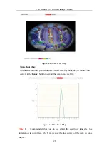 Preview for 138 page of HIKVISION DS-2CD6365G0E-IS User Manual