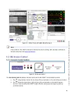 Preview for 51 page of IngMar Medical 420-11955 User Manual