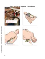 Preview for 16 page of IngMar Medical ASL 5000 Quick Setup Manual