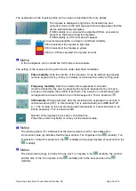 Preview for 38 page of K-LASER Blue Derma Operating Instruction