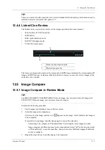 Preview for 179 page of Mindray Anesus ME7T Operator'S Manual