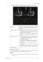 Preview for 127 page of Mindray TE X Operator'S Manual