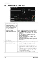 Preview for 148 page of Mindray TE X Operator'S Manual