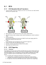 Preview for 122 page of Mindray TE5 Operator'S Manual