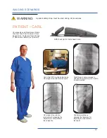 Preview for 15 page of OAKWORKS Spine Positioning System II User Manual