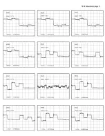 Preview for 93 page of Philips 43P 8341 Service Manual