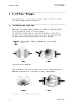 Preview for 18 page of Physiomed PHYSIOTHERM-S Operating Instructions Manual