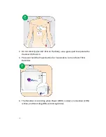 Preview for 33 page of QT Medical QT ECG QTERD100 User Manual