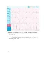 Preview for 44 page of QT Medical QT ECG QTERD100 User Manual