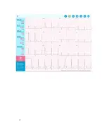 Preview for 47 page of QT Medical QT ECG QTERD100 User Manual