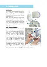 Preview for 14 page of Schuchmann hts. Instructions For Use Manual