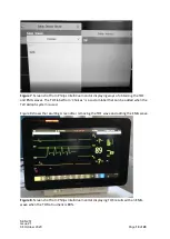 Preview for 12 page of SENZIME TetraGraph Philips Interface Operating Instructions Manual