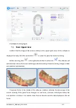 Preview for 43 page of Shining 3D Aoralscan 3 Manual