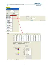 Preview for 43 page of SOMNOmedics SOMNOwatch plus Instruction Manual