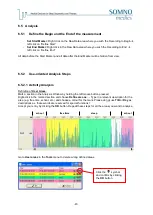 Preview for 47 page of SOMNOmedics SOMNOwatch plus Instruction Manual