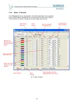 Preview for 91 page of SOMNOmedics SOMNOwatch plus Instruction Manual