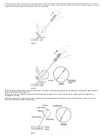 Preview for 10 page of Terumo Angio-Seal VIP Instructions For Use Manual