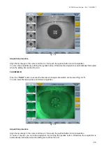 Preview for 25 page of Topcon CA-200F Instructions For Use Manual