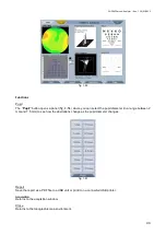 Preview for 43 page of Topcon CA-200F Instructions For Use Manual