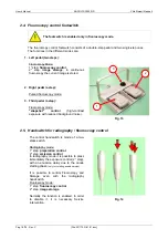 Preview for 20 page of Villa Sistemi Medicali Arcovis 3000 User Manual