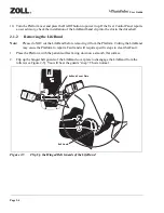 Preview for 26 page of ZOLL AutoPulse 100 User Manual