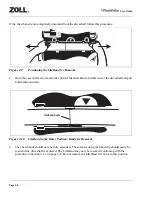 Preview for 30 page of ZOLL AutoPulse 100 User Manual