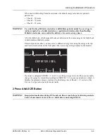 Preview for 57 page of ZOLL R Series Operator'S Manual