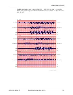 Preview for 77 page of ZOLL R Series Operator'S Manual