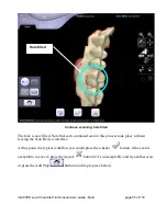 Предварительный просмотр 55 страницы 3M ESPE Lava Chairside Oral Scanner User Manual