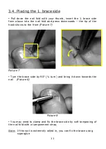 Предварительный просмотр 11 страницы 3TO BRACE Set Of Instructions