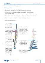 Preview for 7 page of AAP LOQTEQ Distal Dorsolateral Humerus Plate... Manual