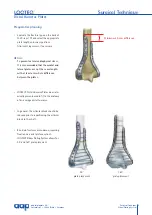 Preview for 11 page of AAP LOQTEQ Distal Dorsolateral Humerus Plate... Manual