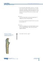 Preview for 25 page of AAP LOQTEQ Distal Dorsolateral Humerus Plate... Manual